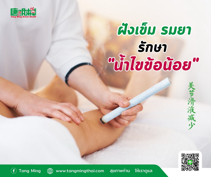 ฝังเข็ม รมยา 